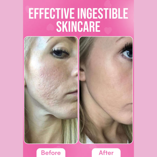 It Girl Skin – Skin Food