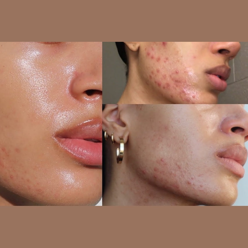It Girl Skin – Skin Food