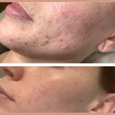 It Girl Skin – Skin Food