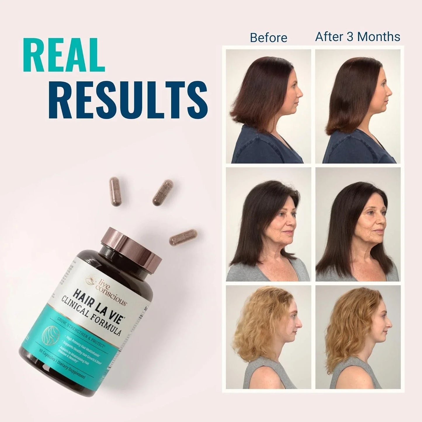 Hair La Vie Live Conscious Clinical Formula – 90‑Count Hair Growth Vitamins (Biotin, Saw Palmetto, Collagen)