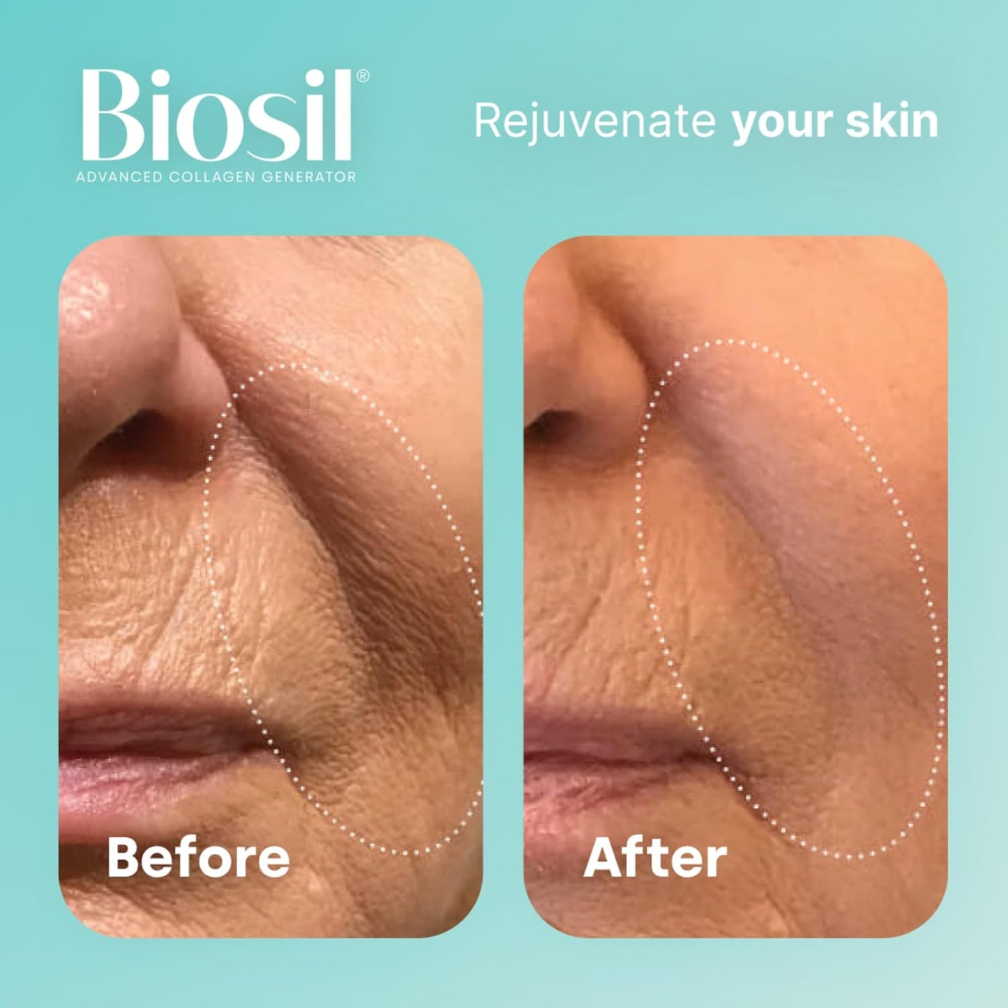 Biosil Collagen Generator -with Patented ch-OSA Complex 120 Capsules