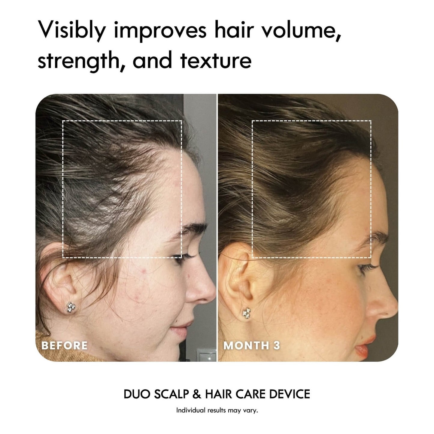 Laduora DUO 4-in-1 Pod Based Scalp & Hair Care Device