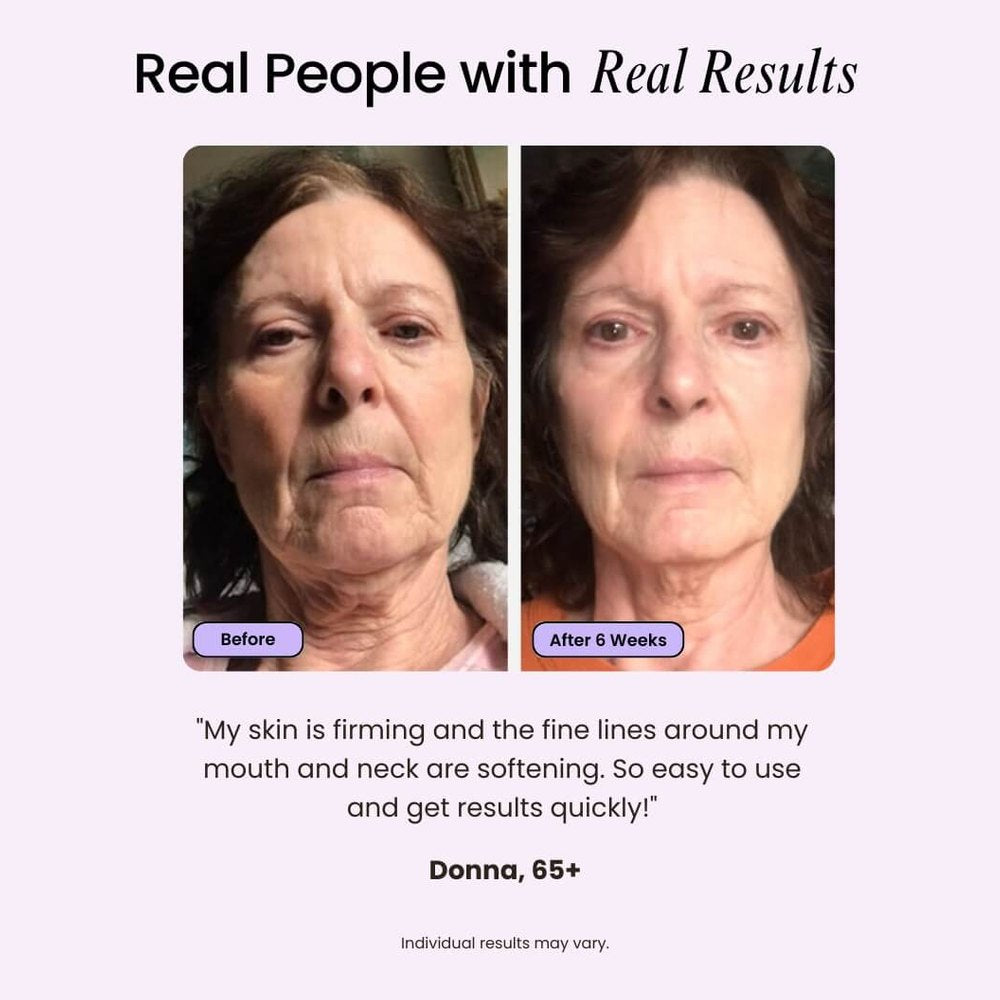 Velve Pro 5-in-1 Skincare Wand Complete Kit