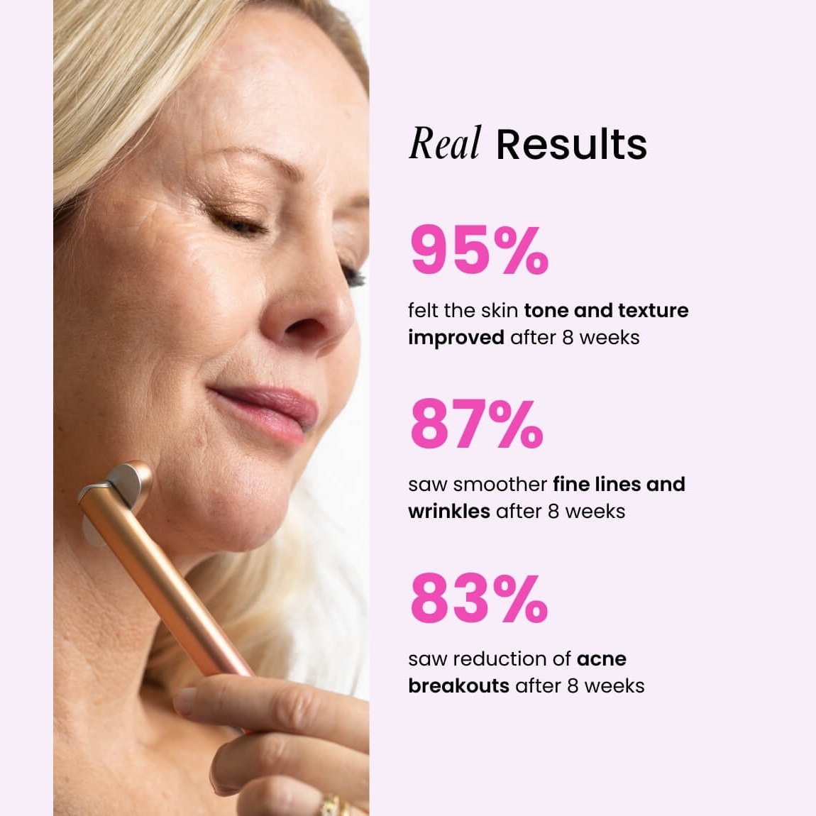 Advertisement showing a woman using a skincare device with statistics on skin improvement.
