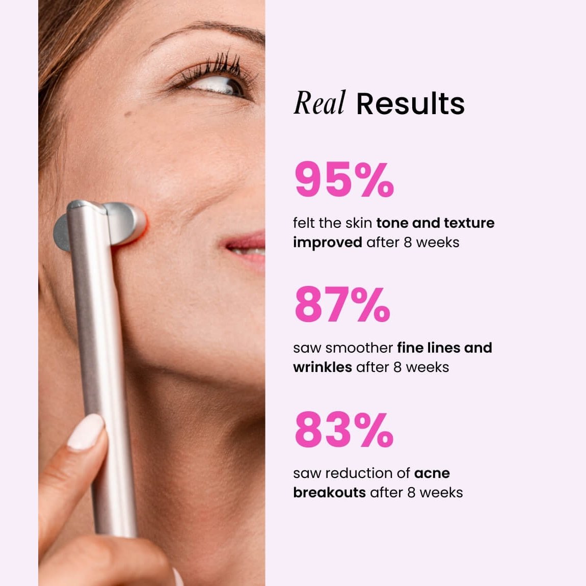 Velve Pro 5-in-1 Skincare Wand