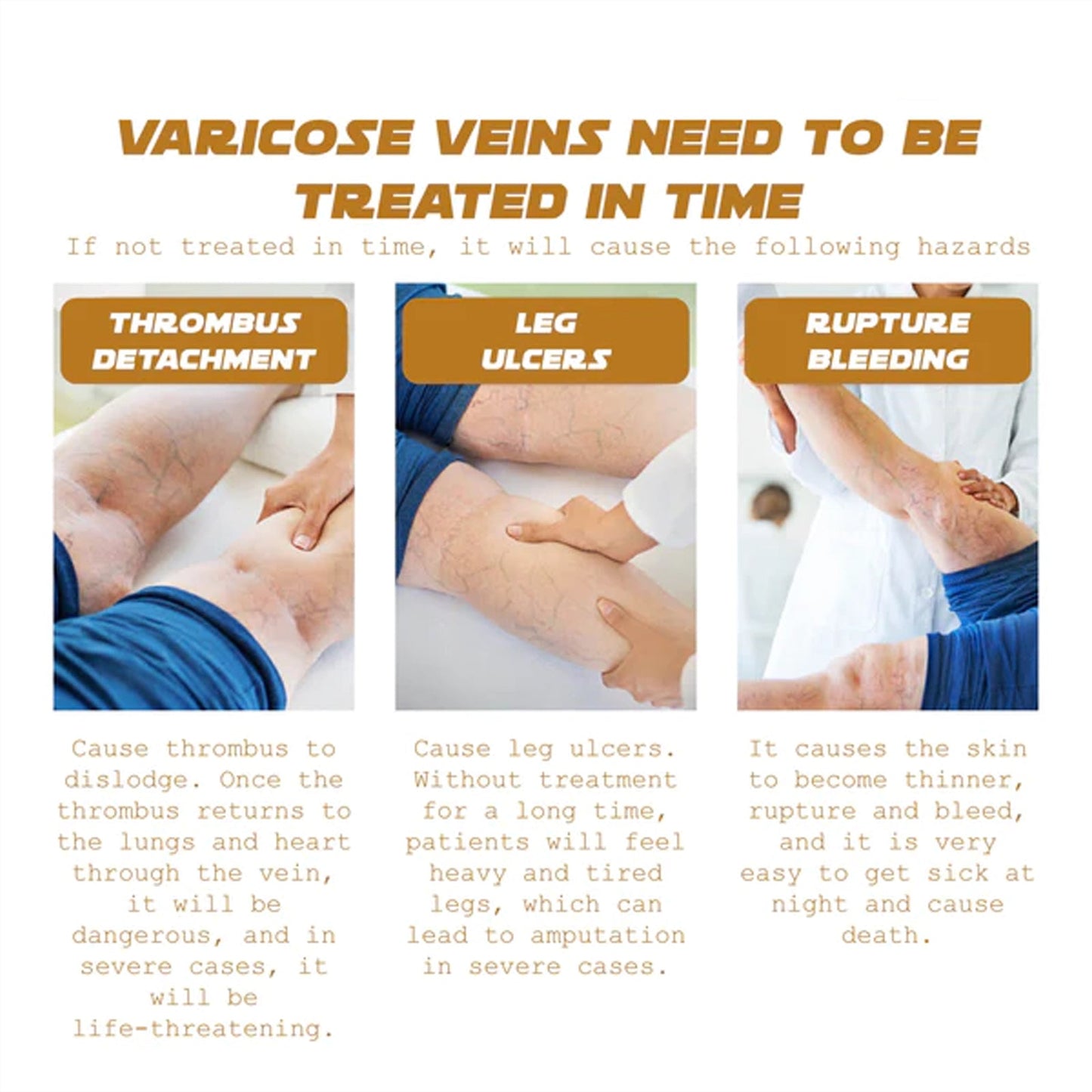 Ximonth Vein Renewal Smooth Legs Cream, Relief Sore Legs Massage Varicose Earthworm Leg Vein Care Cream