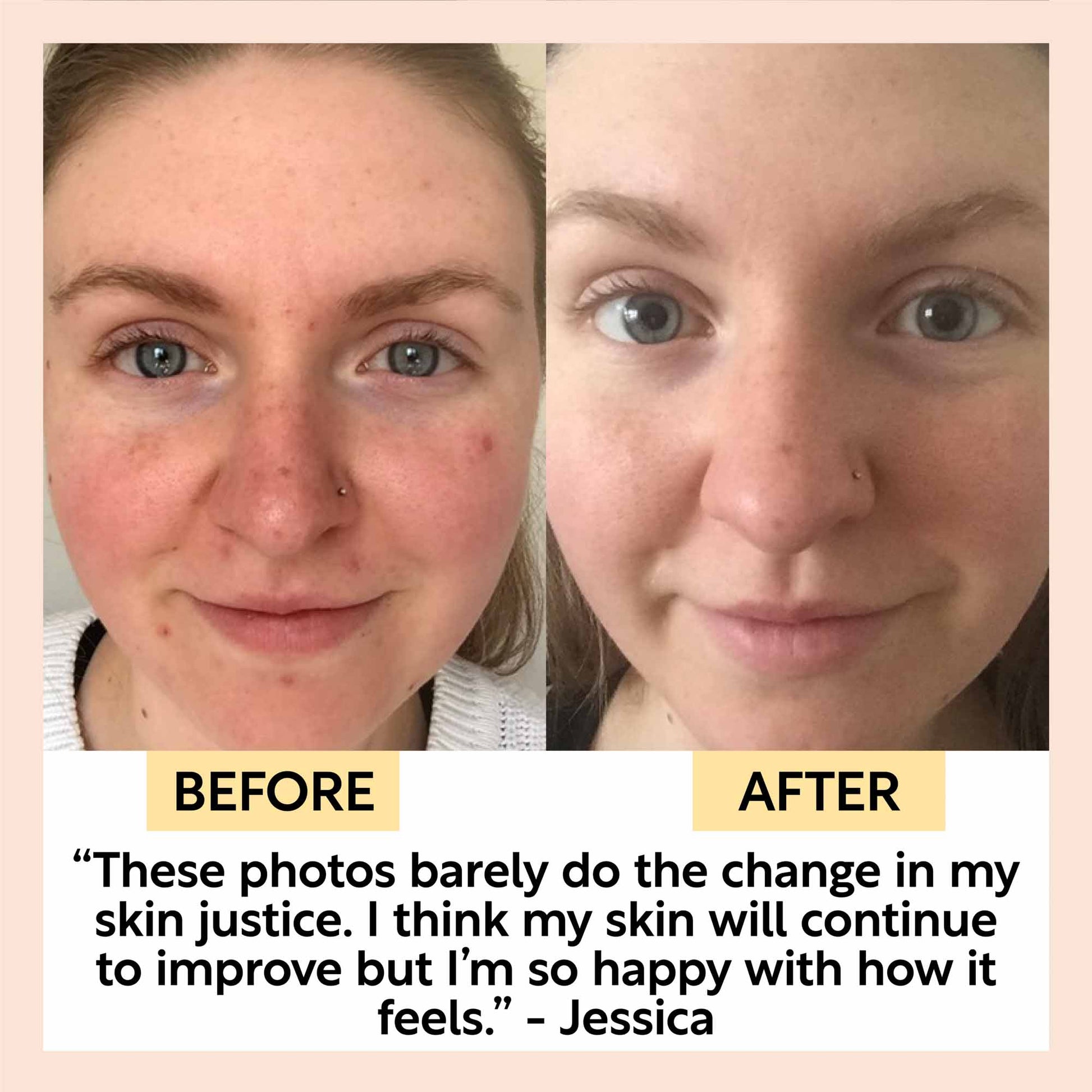 Before and after comparison of a person's face with text overlay.