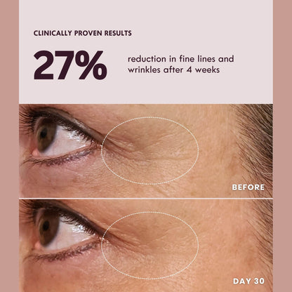 Lumeo SkinLift 4D Current™ Red Light Therapy Kit