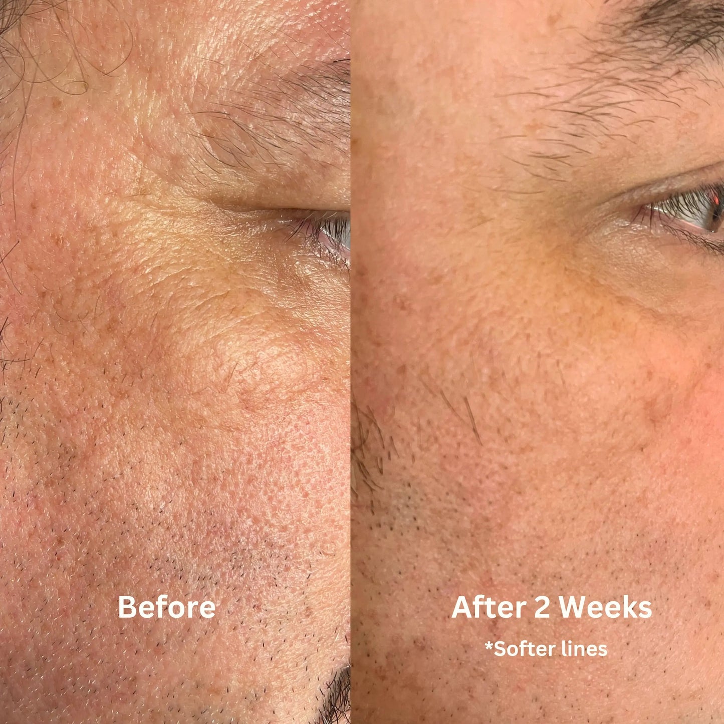 Luster Bakuchiol + Astaxanthin Face Oil Retinol Alternative