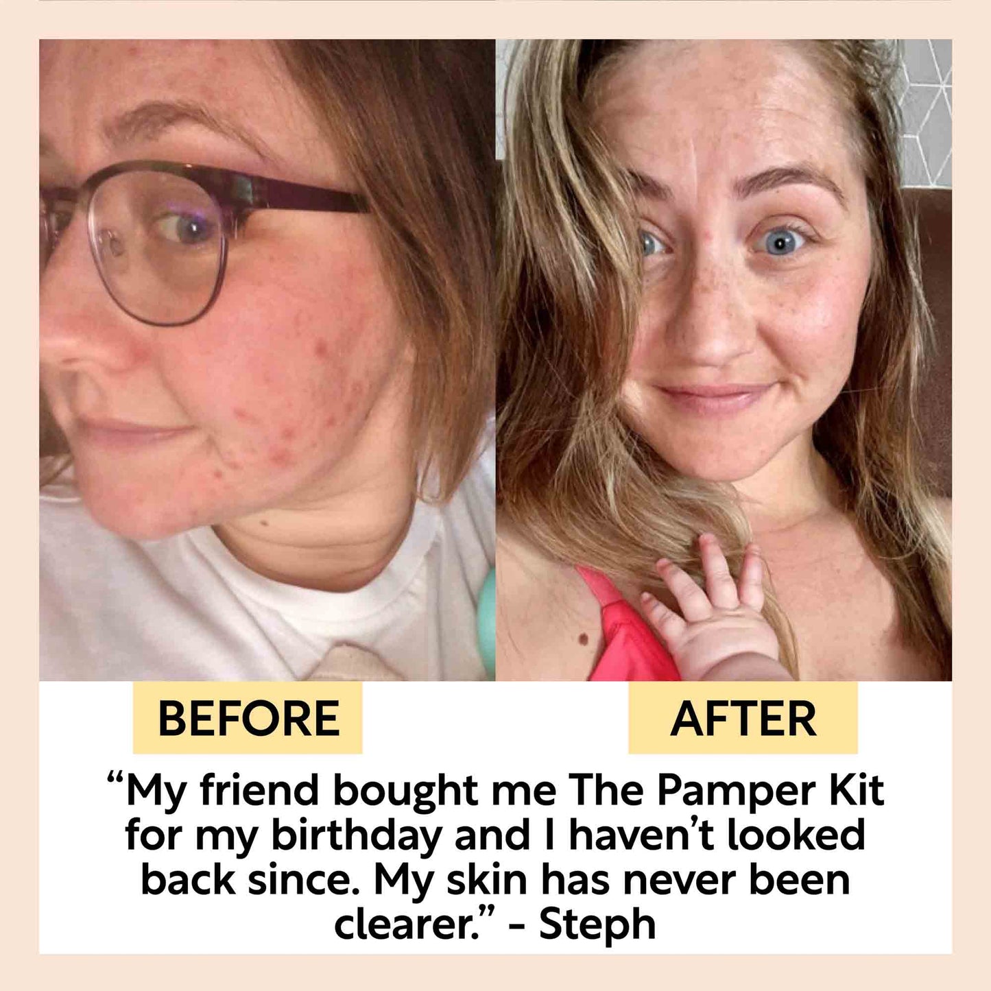"Pamper + Gift" Skincare Kit