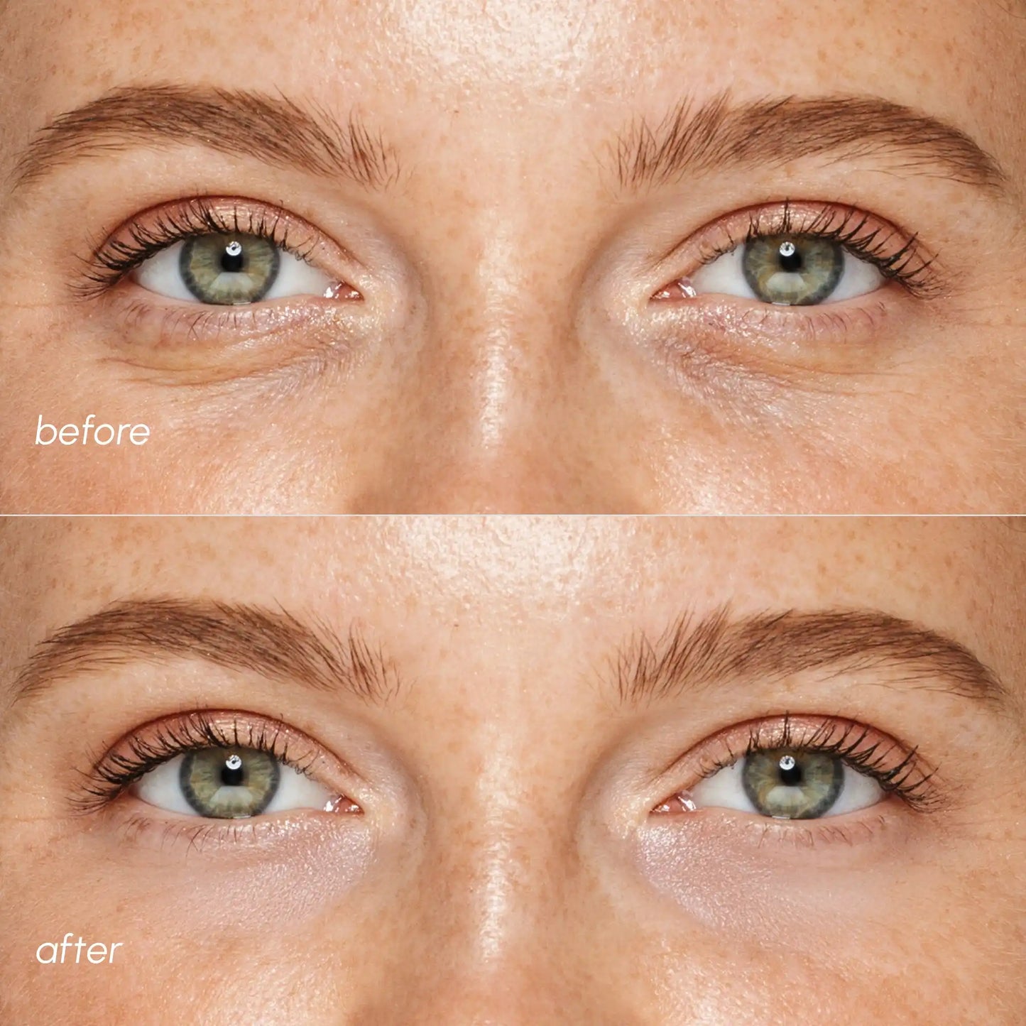 Pink Eye Patches for Puffy Eyes