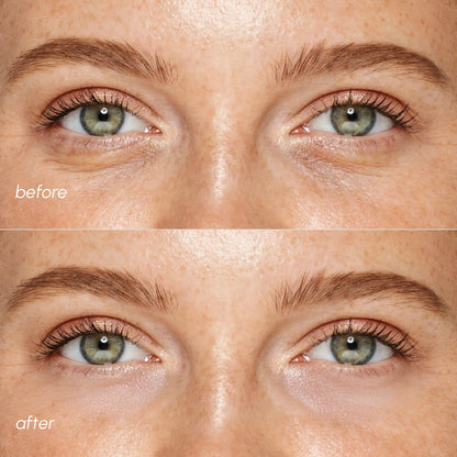 Pink Eye Patches for Puffy Eyes