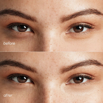 Pink Eye Patches for Puffy Eyes