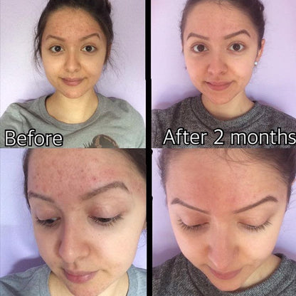 Before and after comparison of a woman's face with text indicating time elapsed.