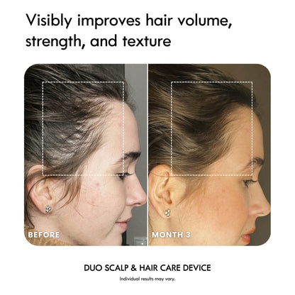 Laduora DUO 4-in-1 Pod Based Scalp & Hair Care Device