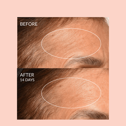 Theorem Serum Boost